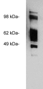 " Western blot using Exalpha’s X1847P, affinity purified rabbit polyclonal at 0.5 ug/ml on  
HeLa cell extract (20 ug/lane). Blots were developed with goat anti-rabbit Ig (1:75k) and Pierce’s Supersignal West Femto system."